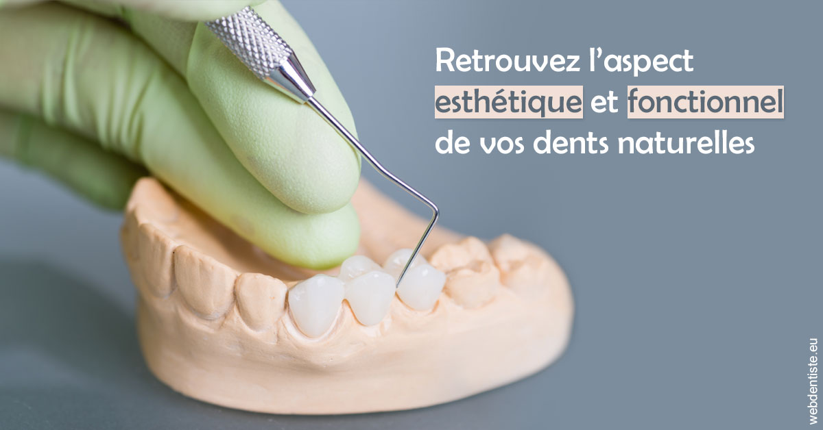 https://www.orthofalanga.fr/Restaurations dentaires 1