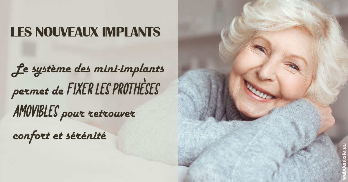 https://www.orthofalanga.fr/Les nouveaux implants 1