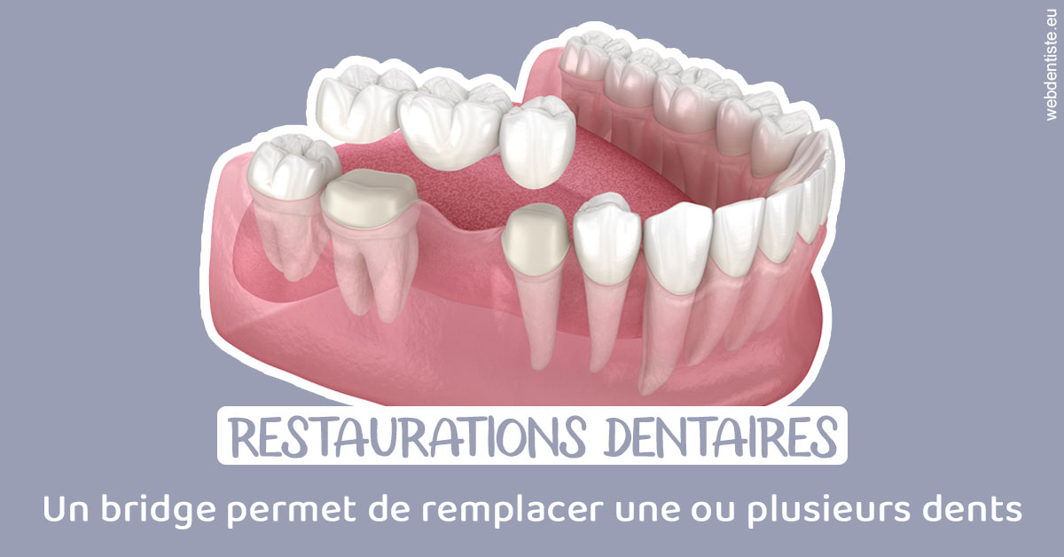 https://www.orthofalanga.fr/Bridge remplacer dents 1