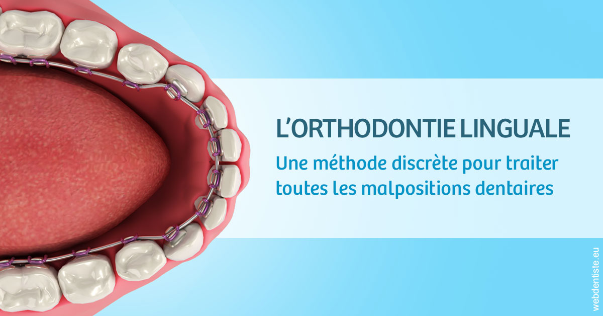 https://www.orthofalanga.fr/L'orthodontie linguale 1