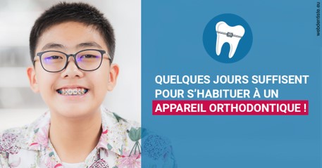 https://www.orthofalanga.fr/L'appareil orthodontique