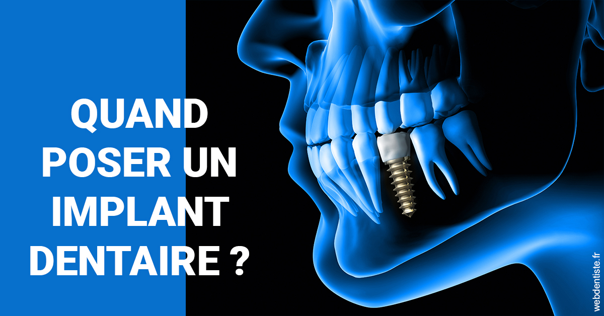 https://www.orthofalanga.fr/Les implants 1