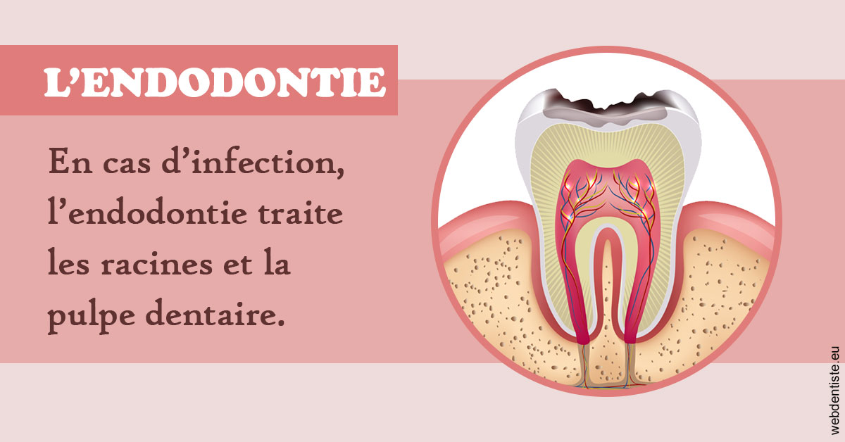 https://www.orthofalanga.fr/L'endodontie 2