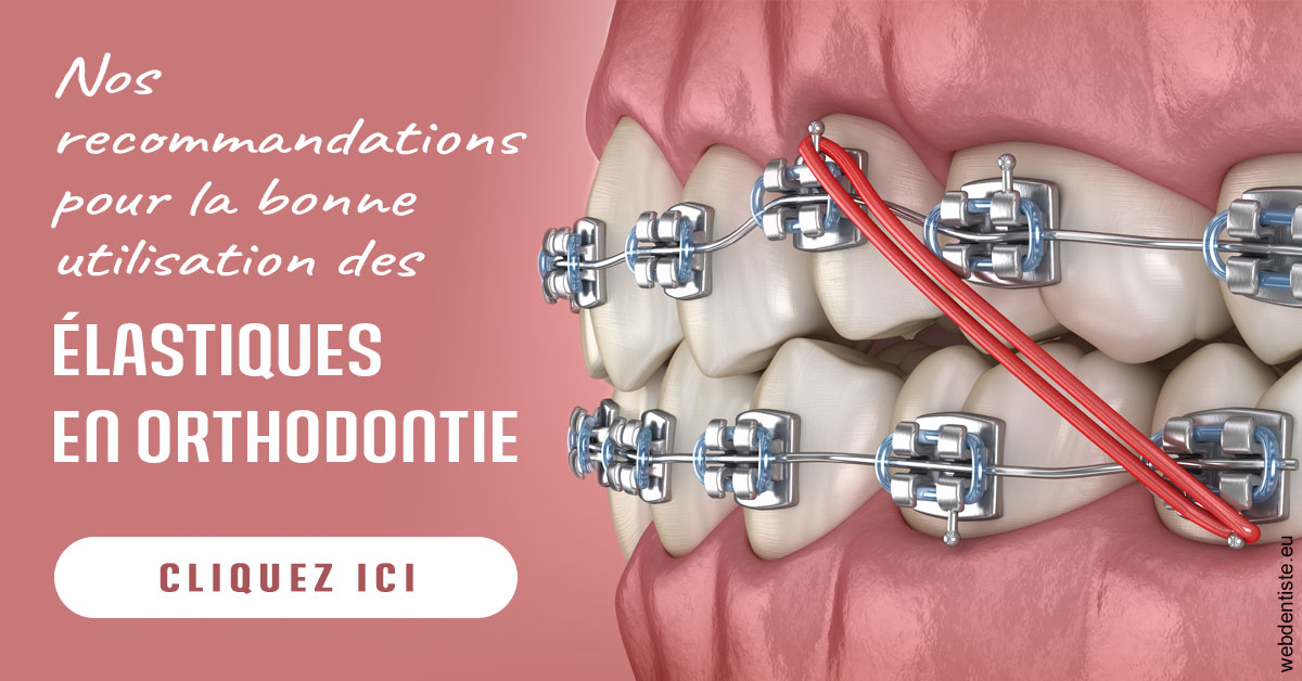 https://www.orthofalanga.fr/Elastiques orthodontie 2